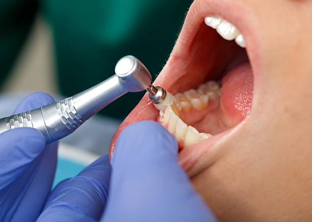 Best Root Canal Treatment  in New York, NY